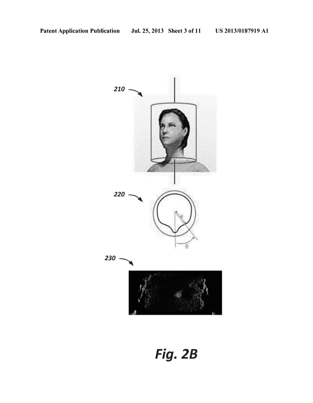 3D Body Modeling, from a Single or Multiple 3D Cameras, in the Presence of     Motion - diagram, schematic, and image 04