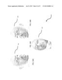 Portable Structured Light Measurement Module/Apparatus with Pattern     Shifting Device Incorporating a Fixed-pattern Optic for Illuminating a     Subject-under-test diagram and image