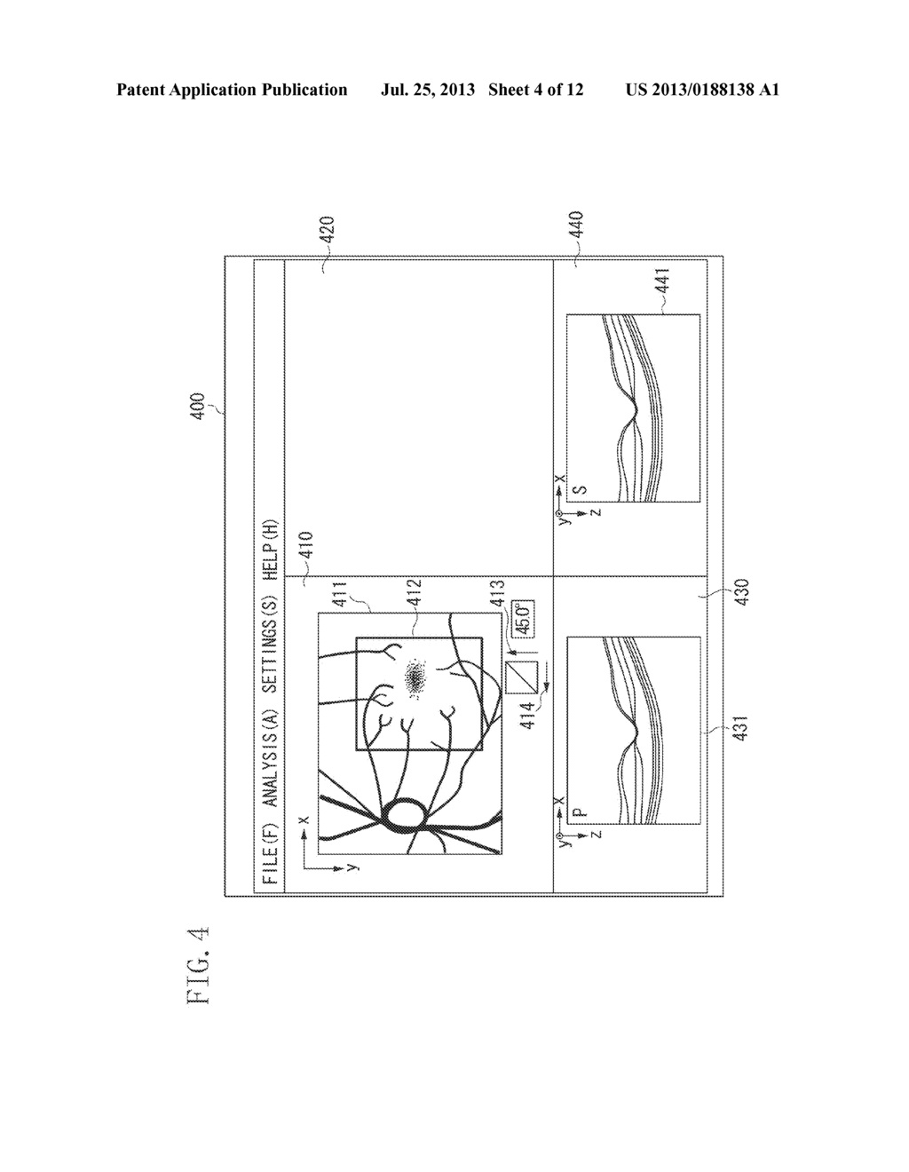 IMAGE PROCESSING APPARATUS AND IMAGE PROCESSING METHOD - diagram, schematic, and image 05