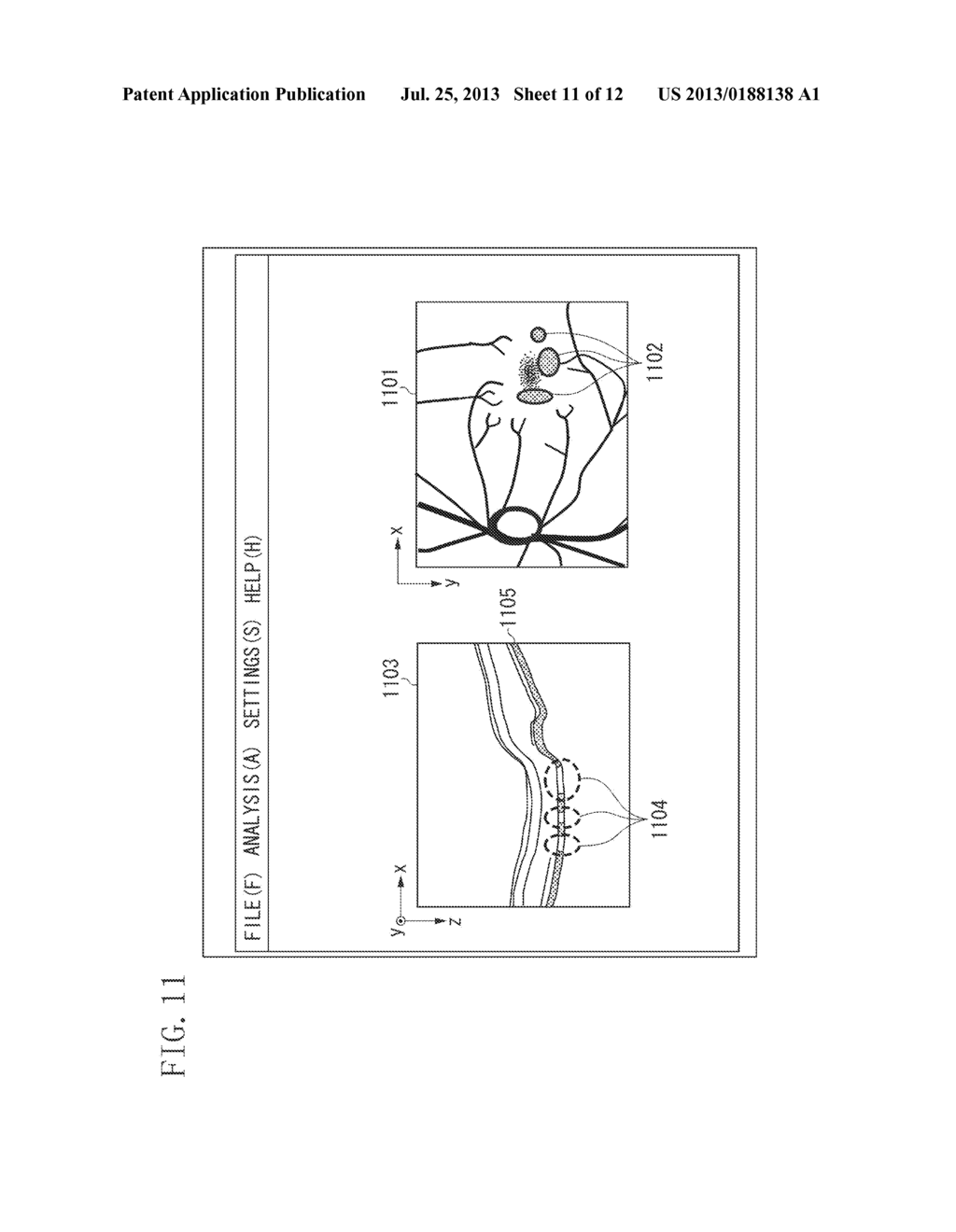 IMAGE PROCESSING APPARATUS AND IMAGE PROCESSING METHOD - diagram, schematic, and image 12