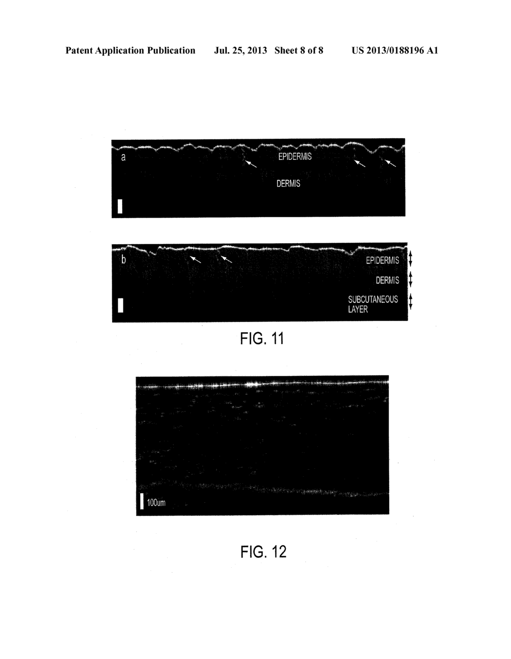 LATERAL DISTORTION CORRECTED OPTICAL COHERENCE TOMOGRAPHY SYSTEM - diagram, schematic, and image 09