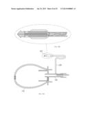 Diaphonic Acoustic Transduction Coupler and Ear Bud diagram and image