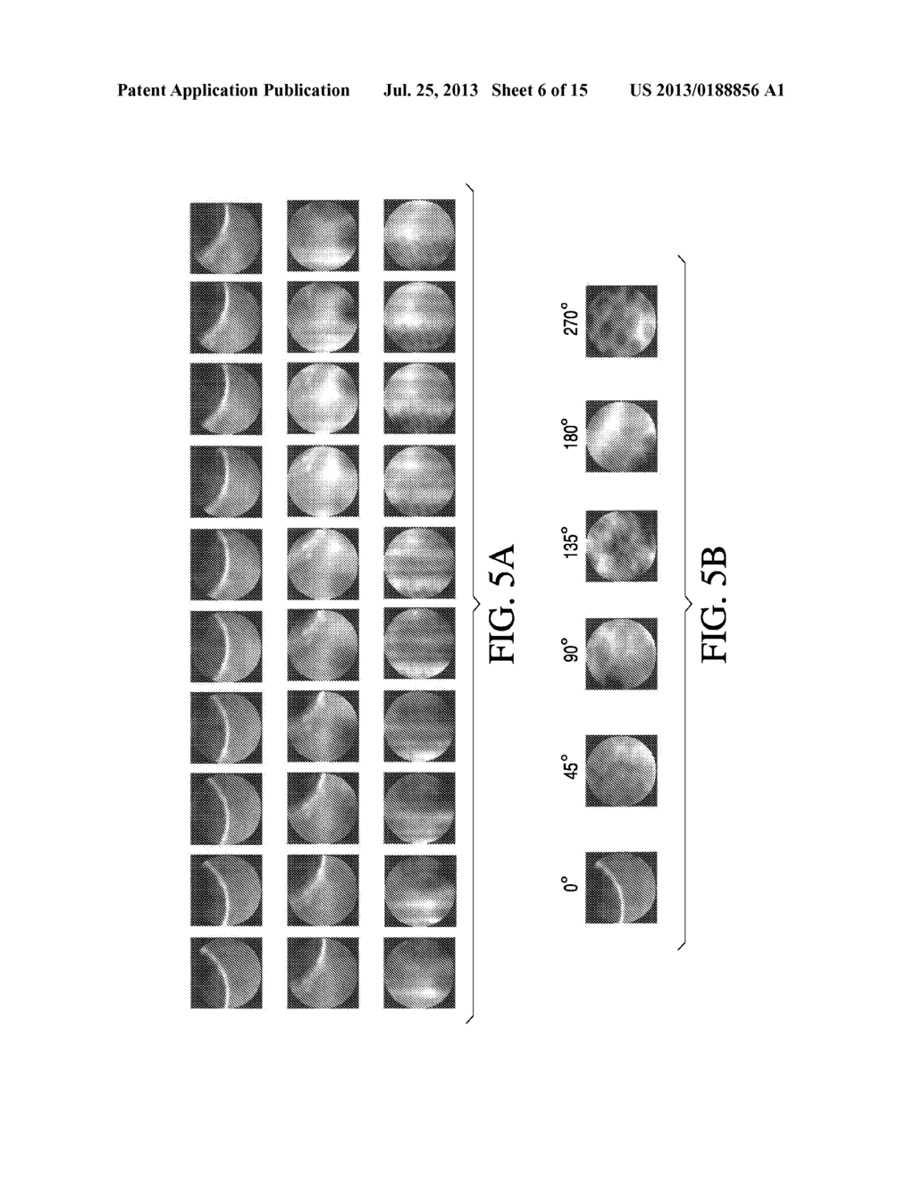 SYSTEMS AND METHODS FOR REAL-TIME TARGET VALIDATION FOR IMAGE-GUIDED     RADIATION THERAPY - diagram, schematic, and image 07