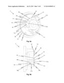 Tooth-Set Carrier and Opening Cylinder with Quick-Locking Mechanism diagram and image