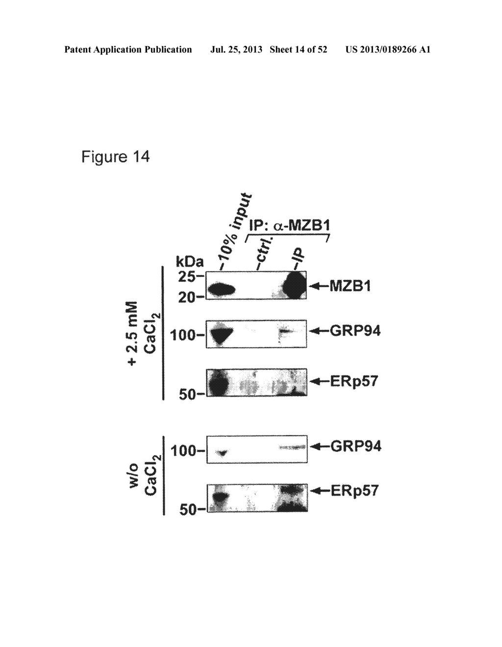 MZB1, A NOVEL B CELL FACTOR, AND USES THEREOF - diagram, schematic, and image 15