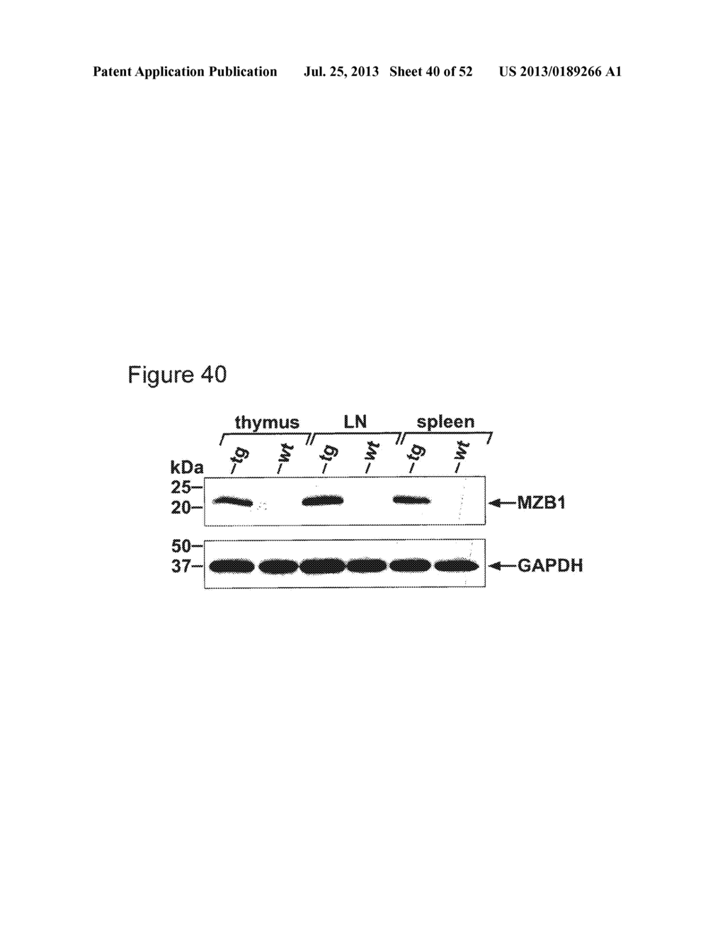 MZB1, A NOVEL B CELL FACTOR, AND USES THEREOF - diagram, schematic, and image 41