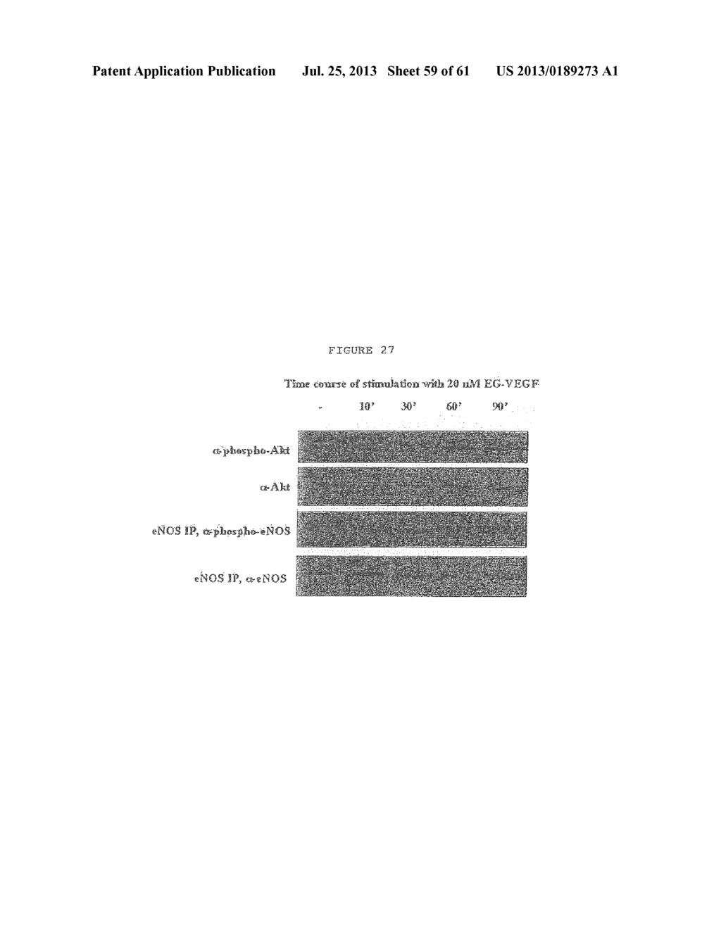 EG-VEGF NUCLEIC ACIDS AND POLYPEPTIDES AND METHODS OF USE - diagram, schematic, and image 60