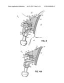 SELF-LIGATING ORTHODONTIC BRACKET diagram and image