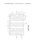 Self Ligating Orthodontic Bracket Having a Rotatable Member diagram and image