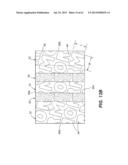 Self Ligating Orthodontic Bracket Having a Rotatable Member diagram and image