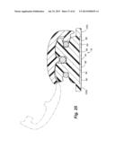 Self Ligating Orthodontic Bracket Having a Rotatable Member diagram and image