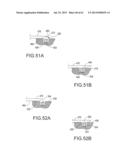 Self Ligating Orthodontic Bracket Having a Rotatable Member diagram and image