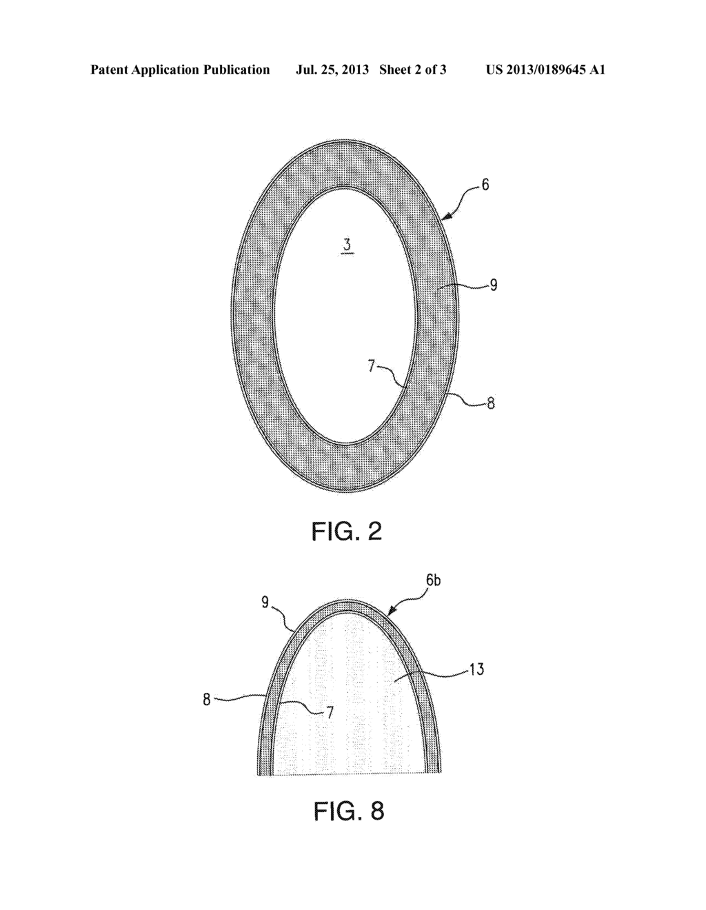 Medical membrane, in particular dental membrane and tooth implant with     such a membrane - diagram, schematic, and image 03