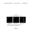 PROCESS FOR THE PRODUCTION OF HYALURONIC ACID IN ESCHERICHIA COLI OR     BACILLUS SUBTILIS diagram and image