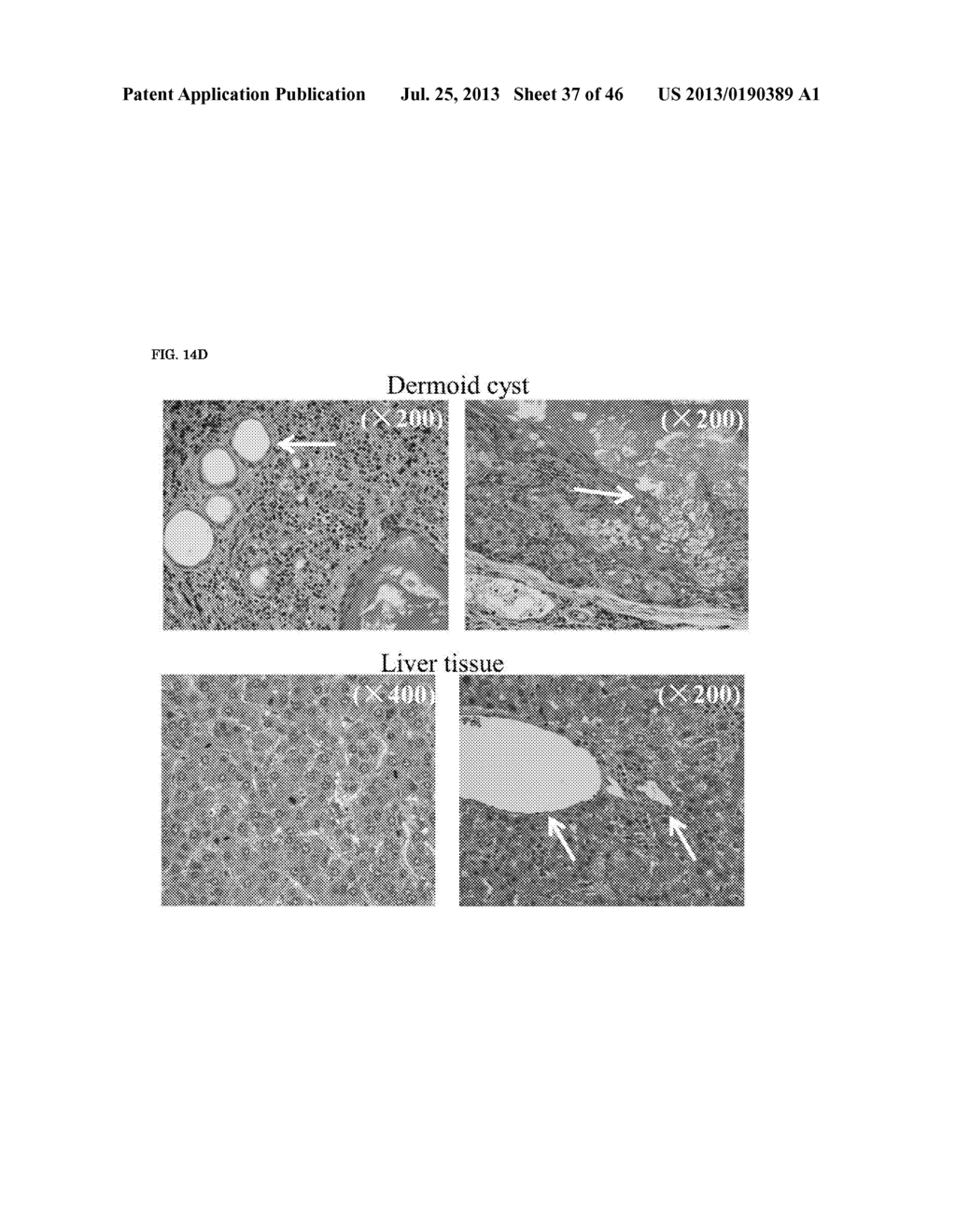 Method For Producing Novel Hipsc By Means Of Mirna Introduction - diagram, schematic, and image 38