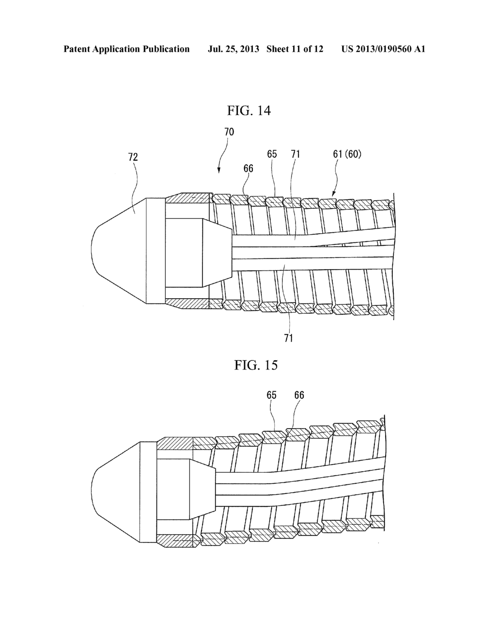 Medical Coil, method of manufacturing the same, and medical instrument - diagram, schematic, and image 12