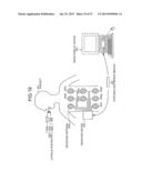 CAPSULE ENDOSCOPE diagram and image