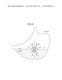 CAPSULE ENDOSCOPE diagram and image