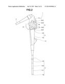 ENDOSCOPE diagram and image