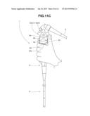 ENDOSCOPE diagram and image