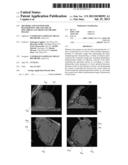 METHODS AND SYSTEMS FOR DETERMINING THE VOLUME OF EPICARDIAL FAT FROM     VOLUMETRIC IMAGES diagram and image