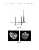 METHODS AND SYSTEMS FOR DETERMINING THE VOLUME OF EPICARDIAL FAT FROM     VOLUMETRIC IMAGES diagram and image