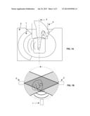 Dynamic Optoacoustic Angiography of Peripheral Vasculature diagram and image