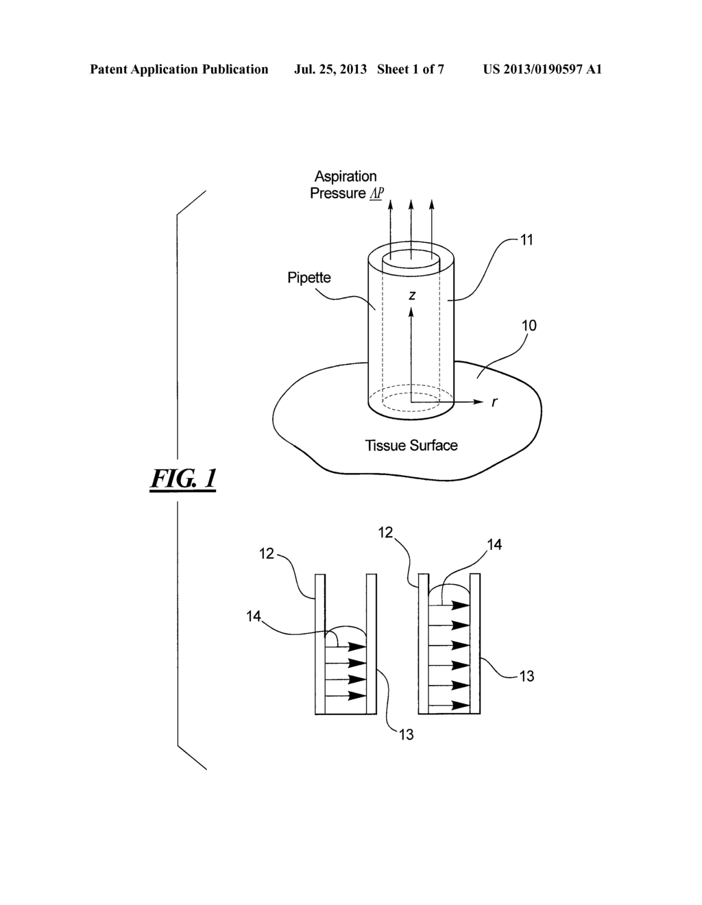 Method and Device for Evaluation of Local Tissue's Biological or     Biomechanical Character - diagram, schematic, and image 02