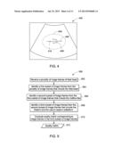 System and Method for Identifying an Optimal Image Frame for Ultrasound     Imaging diagram and image