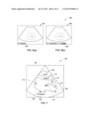 System and Method for Identifying an Optimal Image Frame for Ultrasound     Imaging diagram and image