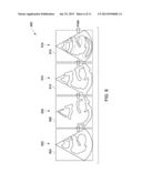 System and Method for Identifying an Optimal Image Frame for Ultrasound     Imaging diagram and image