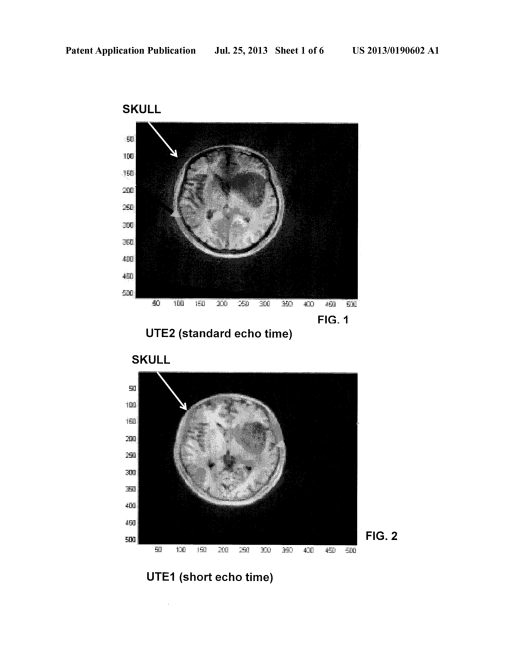 2D3D REGISTRATION FOR MR-X RAY FUSION UTILIZING ONE ACQUISITION OF MR DATA - diagram, schematic, and image 02