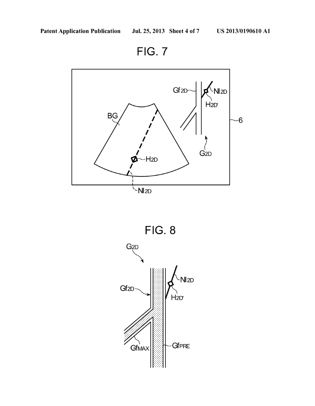 ULTRASOUND DIAGNOSTIC APPARATUS AND METHOD - diagram, schematic, and image 05