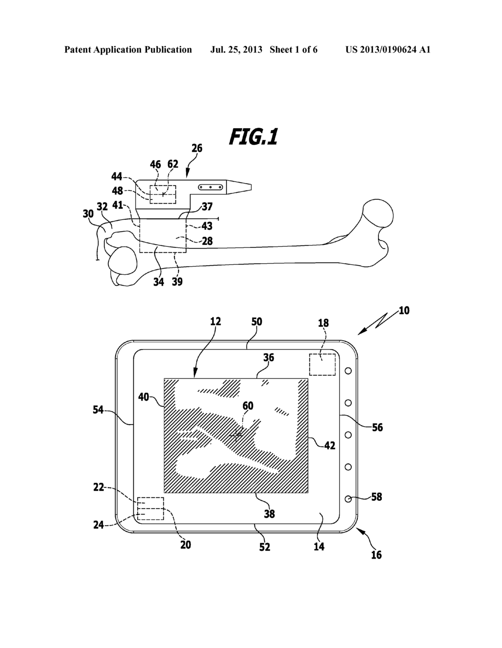 METHOD AND APPARATUS FOR DISPLAYING AN ULTRASOUND IMAGE - diagram, schematic, and image 02