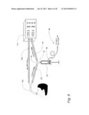 UTILIZING LIPOPOLYSACCHARIDE IN EXHALED BREATH CONDENSATE TO DIAGNOSE GRAM     NEGATIVE PNEUMONIA diagram and image