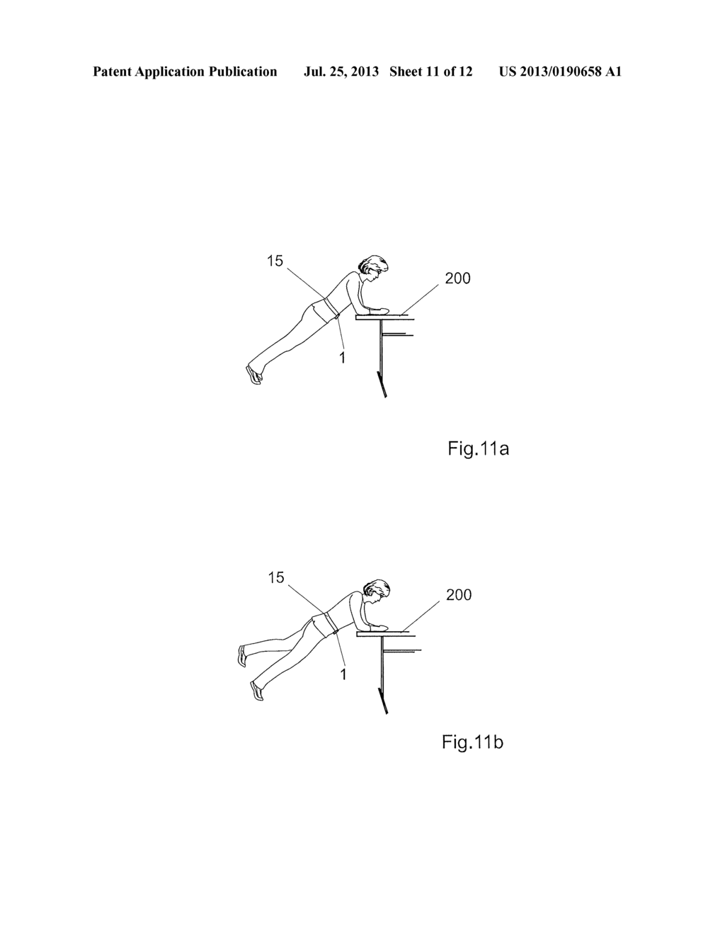 INTEGRATED PORTABLE DEVICE AND METHOD IMPLEMENTING AN ACCELEROMETER FOR     DETECTING ASYMMETRIES IN A MOVEMENT OF A USER - diagram, schematic, and image 12