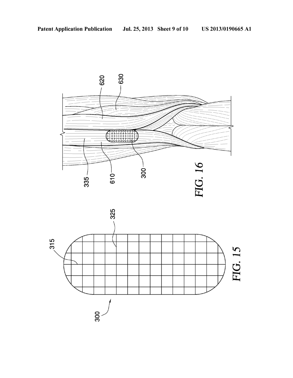 TOPICAL PROPRIOCEPTIVE ACL TUBE AND METHODS OF USE - diagram, schematic, and image 10