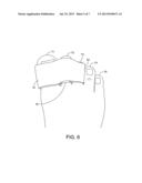 Device for correcting an underlapping or overlapping toe or finger diagram and image