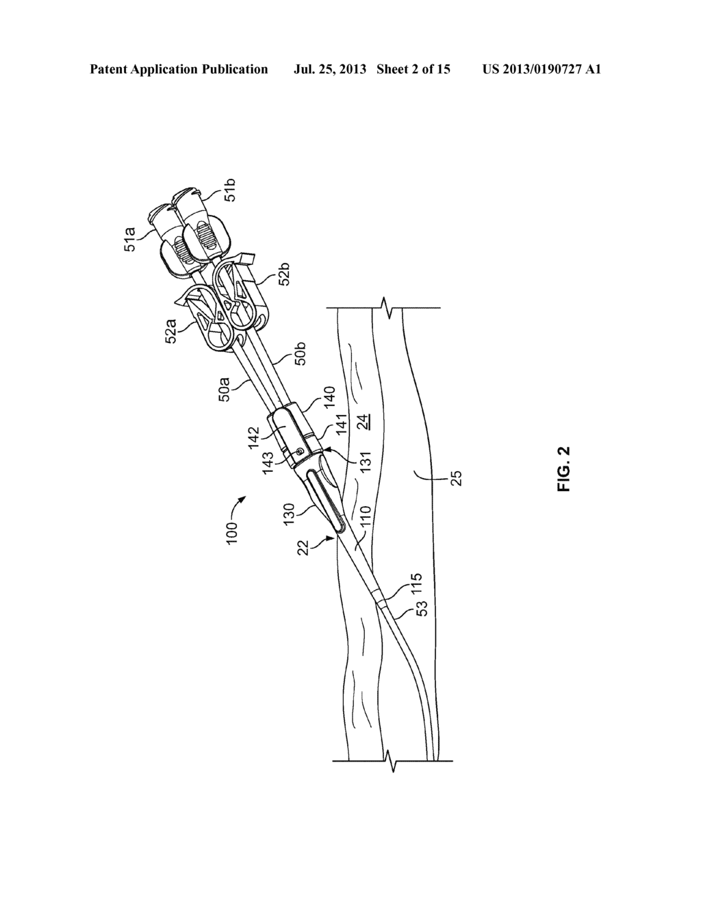 Anchoring a Medical Instrument - diagram, schematic, and image 03