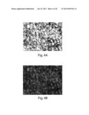 METHODS AND DEVICES FOR SELECTIVE DISRUPTION OF VISCERAL FAT BY CONTROLLED     COOLING diagram and image