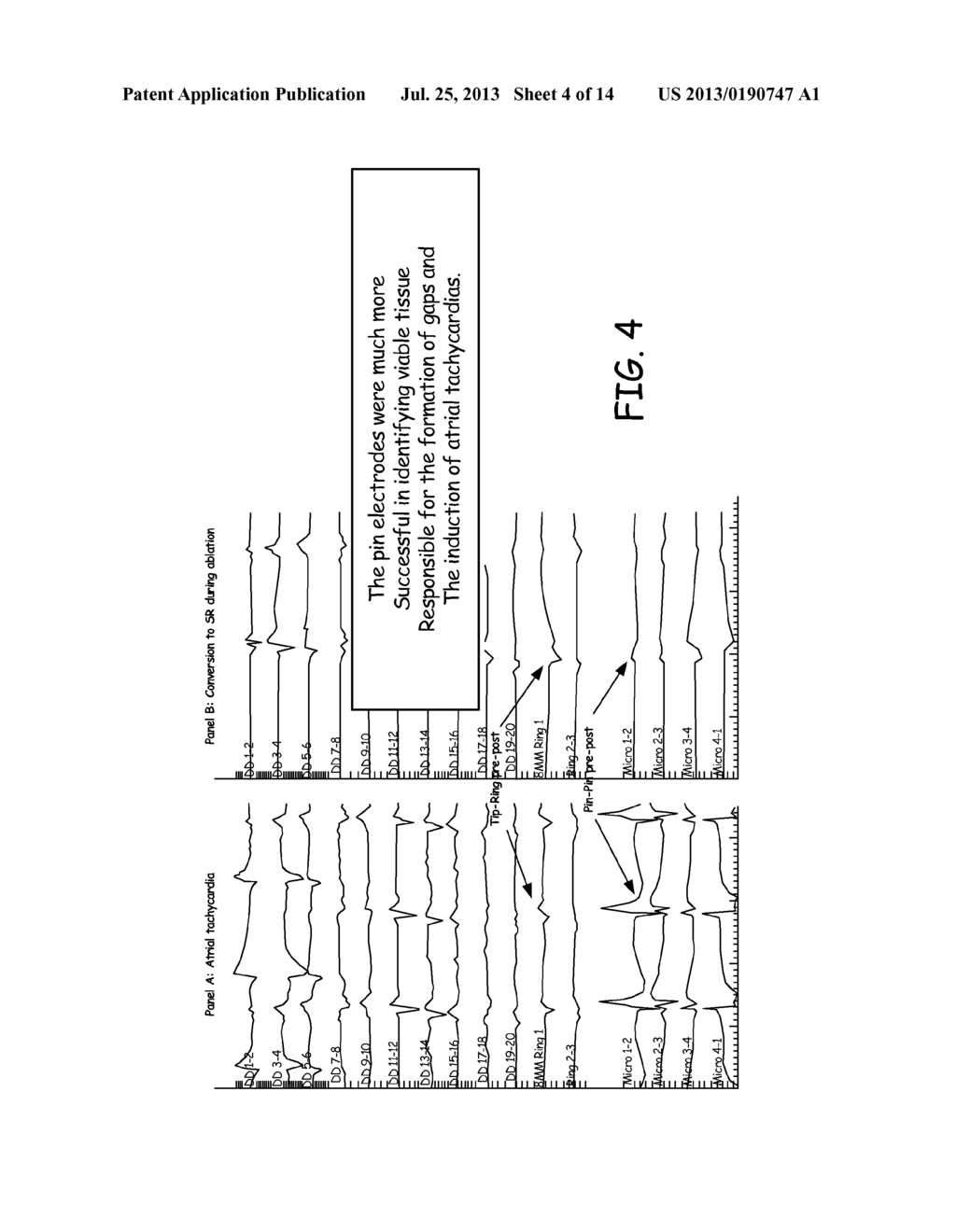 ELECTROPHYSIOLOGY SYSTEM AND METHODS - diagram, schematic, and image 05