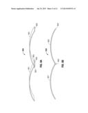 Surgical Instrument With Resilient Driving Member and Related Methods of     Use diagram and image