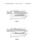 Surgical Tissue Sealer diagram and image