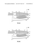 Surgical Tissue Sealer diagram and image