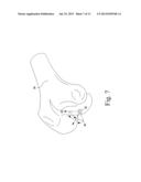 CUSTOMIZED PATIENT-SPECIFIC TIBIAL CUTTING BLOCKS diagram and image