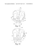 CUSTOMIZED PATIENT-SPECIFIC TIBIAL CUTTING BLOCKS diagram and image