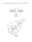 Reusable Surgical Retrieval Apparatus with Disposable Cartridge Assembly diagram and image