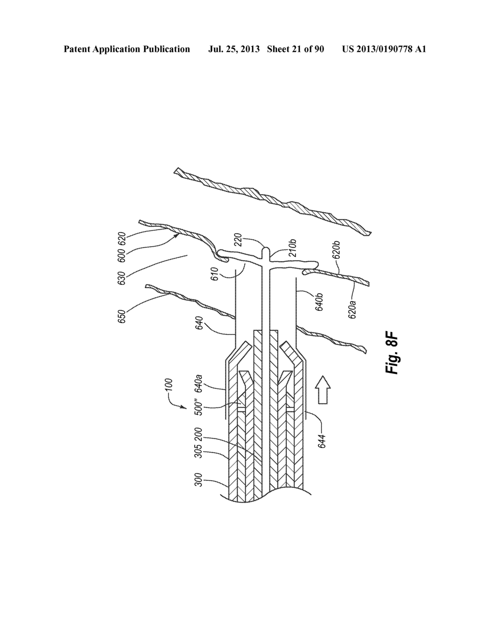 CLIP APPLIER AND METHODS OF USE - diagram, schematic, and image 22