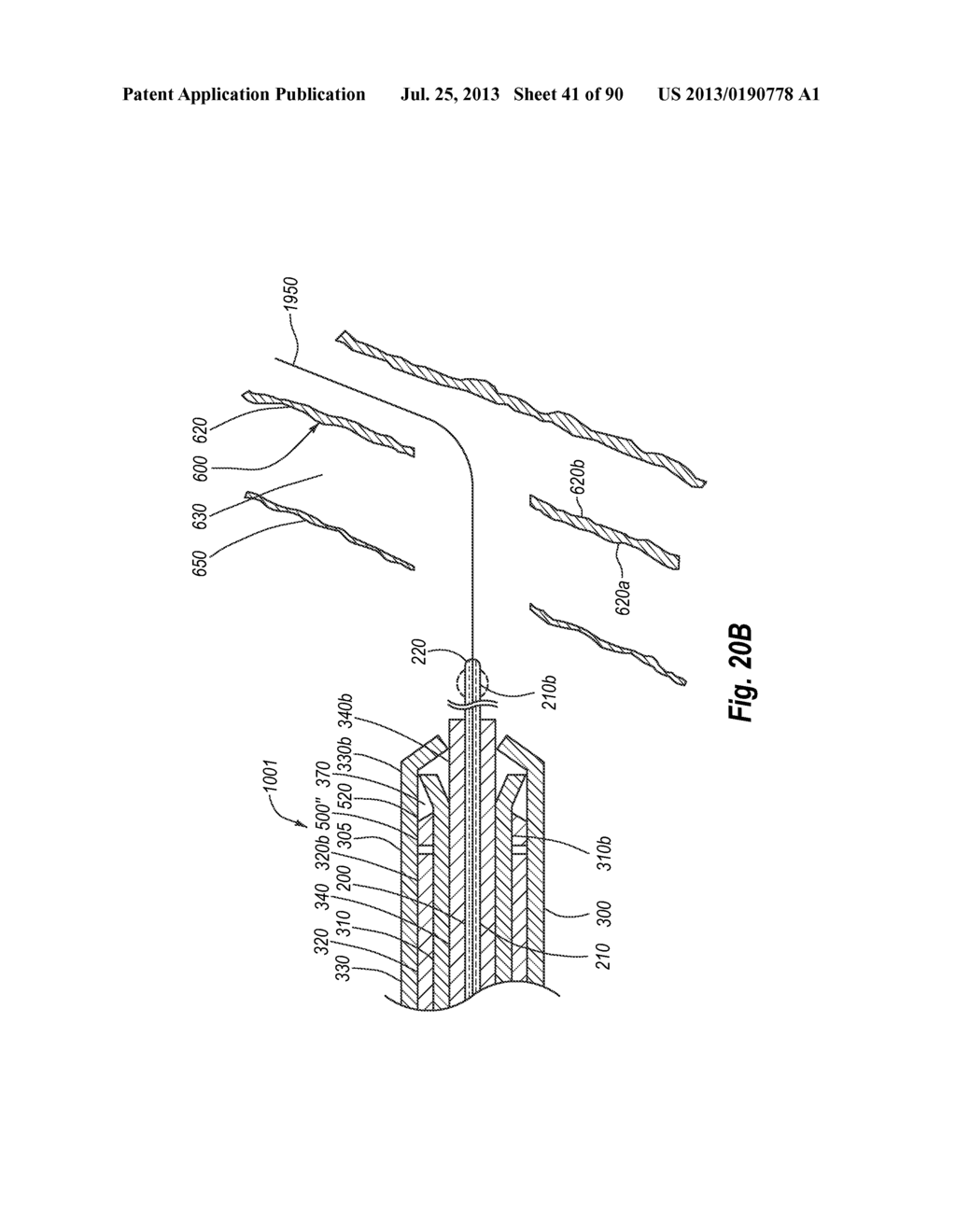 CLIP APPLIER AND METHODS OF USE - diagram, schematic, and image 42