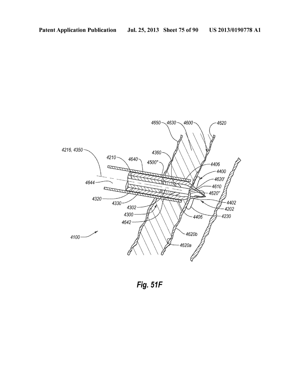 CLIP APPLIER AND METHODS OF USE - diagram, schematic, and image 76